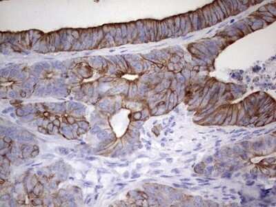 Immunohistochemistry: enkurin Antibody (OTI6C10) - Azide and BSA Free [NBP2-72461]