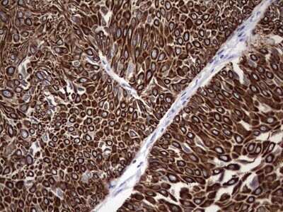 Immunohistochemistry: enkurin Antibody (OTI6C10) - Azide and BSA Free [NBP2-72461]