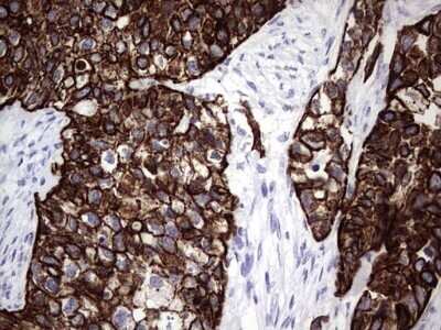 Immunohistochemistry: enkurin Antibody (OTI6C10) - Azide and BSA Free [NBP2-72461]