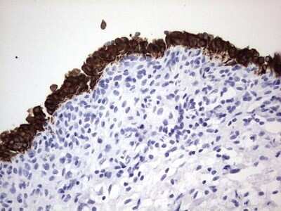 Immunohistochemistry: enkurin Antibody (OTI6C10) - Azide and BSA Free [NBP2-72461]