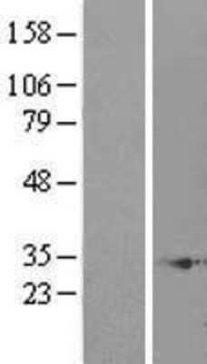 Western Blot: enkurin Overexpression Lysate [NBL1-08083]