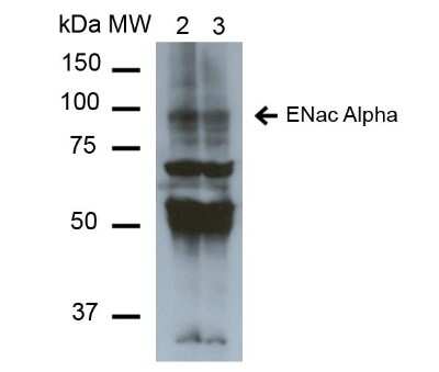 Western Blot: epithelial Sodium Channel alpha Antibody (2G4) [NBP2-59382]