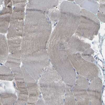 Immunohistochemistry-Paraffin: epithelial Sodium Channel alpha Antibody [NBP1-84846]