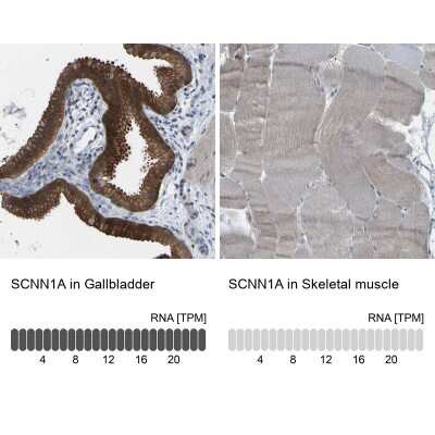 Immunohistochemistry-Paraffin: epithelial Sodium Channel alpha Antibody [NBP1-84846]