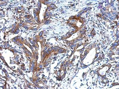 Immunohistochemistry-Paraffin: epithelial Sodium Channel alpha Antibody [NBP2-16353]