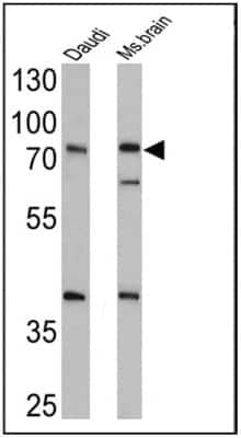 Western Blot: epithelial Sodium Channel alpha Antibody [NB100-74357]