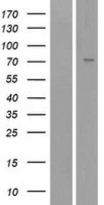 Western Blot: epithelial Sodium Channel alpha Overexpression Lysate [NBP2-10616]