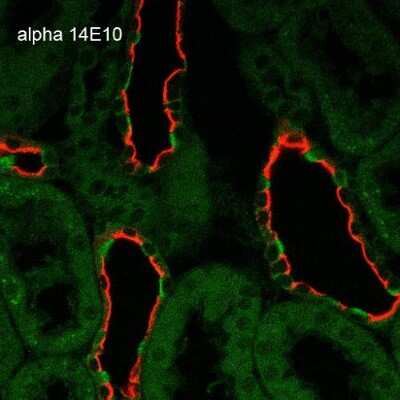 Immunohistochemistry: epithelial Sodium Channel beta Antibody (14E10) [NBP2-59383]
