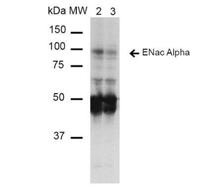 Western Blot: epithelial Sodium Channel beta Antibody (14E10) [NBP2-59383]