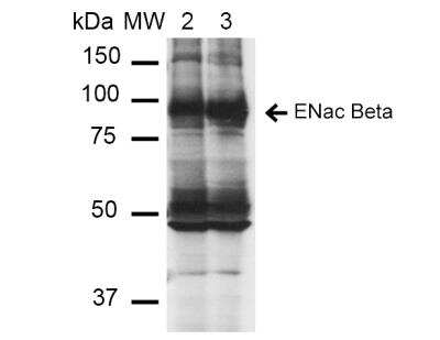 Western Blot: epithelial Sodium Channel beta Antibody (16E4) [NBP2-59381]