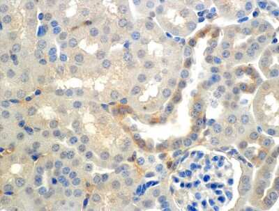 Immunohistochemistry: epithelial Sodium Channel beta Antibody (7B8) [NBP2-59380]