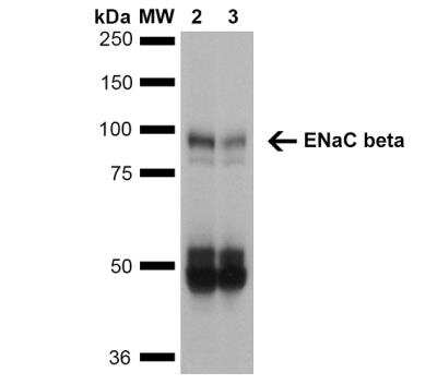 Western Blot: epithelial Sodium Channel beta Antibody (7B8) [NBP2-59380]