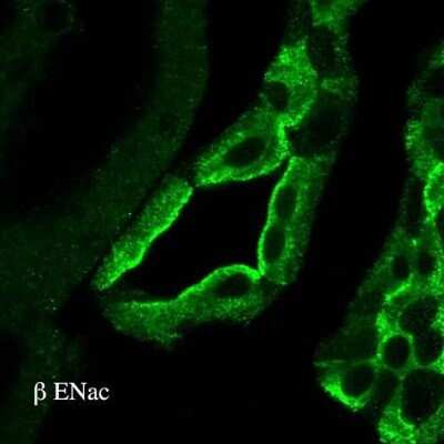 Immunohistochemistry: epithelial Sodium Channel beta Antibody [NBP3-18257]