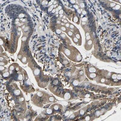 Immunohistochemistry-Paraffin: epithelial Sodium Channel beta Antibody [NBP1-84844]