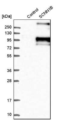 Western Blot: epithelial Sodium Channel beta Antibody [NBP1-84844]