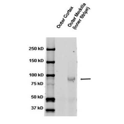 Western Blot: epithelial Sodium Channel beta Antibody [NBP3-18257]