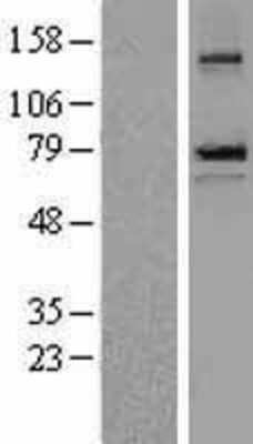 Western Blot: epithelial Sodium Channel beta Overexpression Lysate [NBL1-15746]