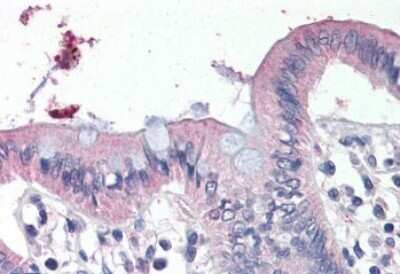 Immunohistochemistry-Paraffin: epithelial Sodium Channel gamma Antibody [NBP1-06075]