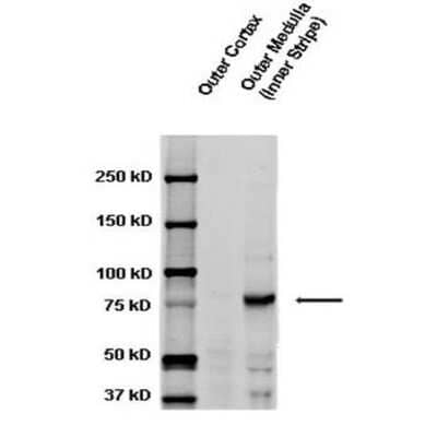 Western Blot: epithelial Sodium Channel gamma Antibody [NBP3-18256]