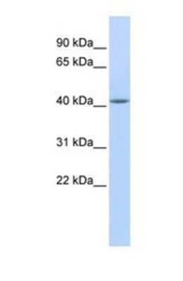 Western Blot: Epithelial Stromal Interaction 1 Antibody [NBP1-69247]