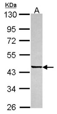 Western Blot: epsilon-Sarcoglycan Antibody [NBP2-20335]