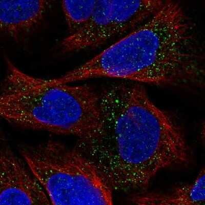 Immunocytochemistry/ Immunofluorescence: espin Antibody [NBP2-55817]