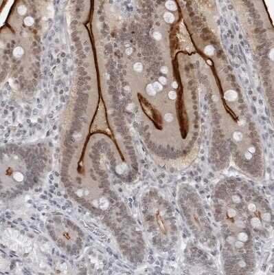 Immunohistochemistry-Paraffin: espin Antibody [NBP1-90588]