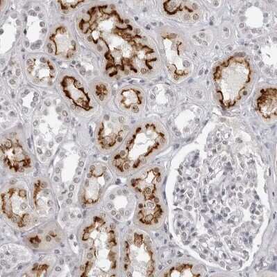 Immunohistochemistry-Paraffin: espin Antibody [NBP1-90588]