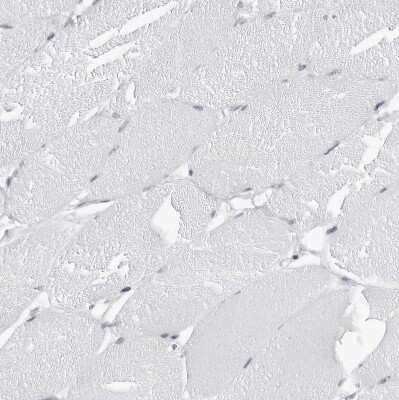 Immunohistochemistry-Paraffin: espin Antibody [NBP1-90588]