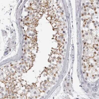 Immunohistochemistry-Paraffin: espin Antibody [NBP1-90588]