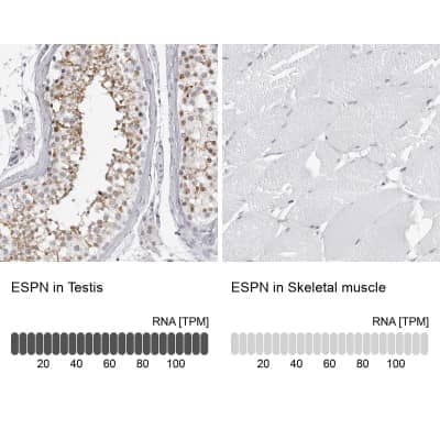 Immunohistochemistry-Paraffin: espin Antibody [NBP1-90588]