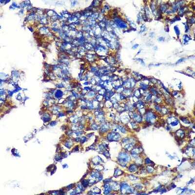 Immunohistochemistry-Paraffin: espin Antibody - Azide and BSA Free [NBP3-03768]