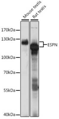 Western Blot: espin AntibodyAzide and BSA Free [NBP3-03768]