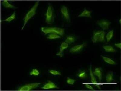 Immunocytochemistry/ Immunofluorescence: ethanolamine kinase Antibody (3F11) [H00055500-M09]