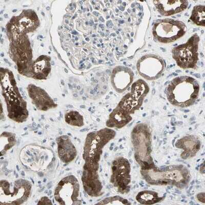 Immunohistochemistry-Paraffin: ethanolamine kinase Antibody [NBP2-33292]