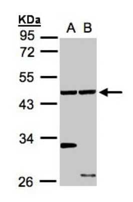 Western Blot: ethanolamine kinase Antibody [NBP1-31606]