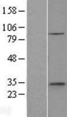 Western Blot: ethanolamine kinase Overexpression Lysate [NBL1-10354]