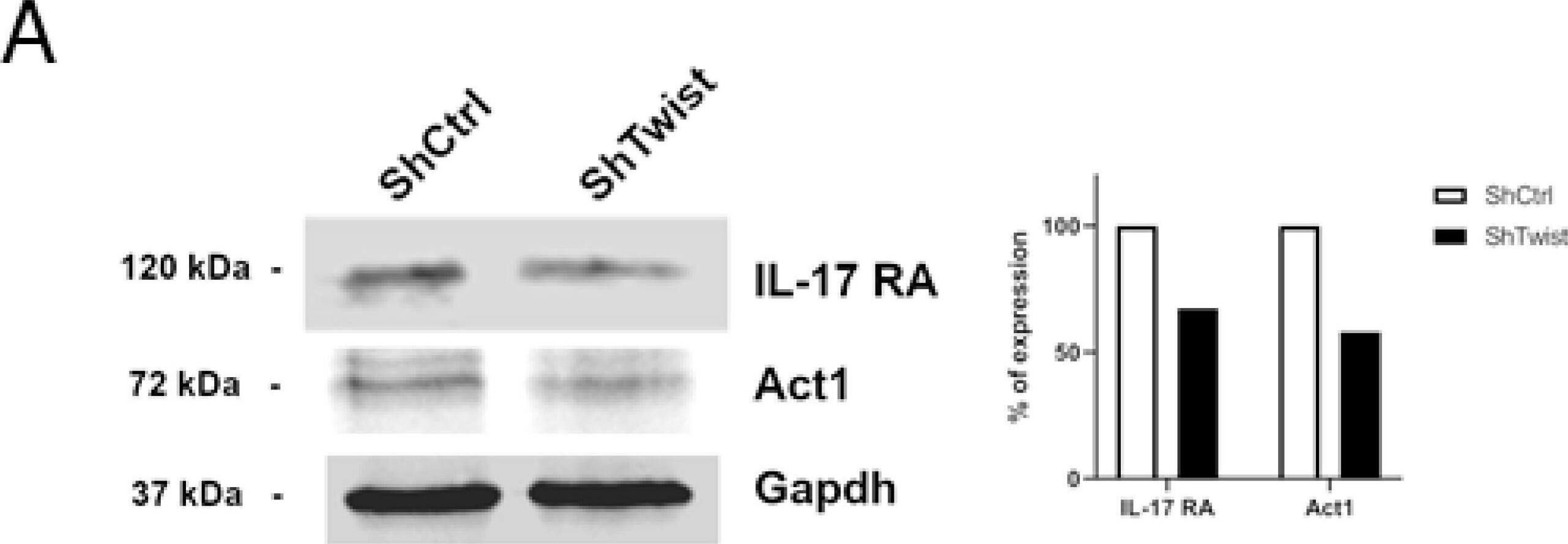 Detection of IL-17RA/IL-17R by Western Blot