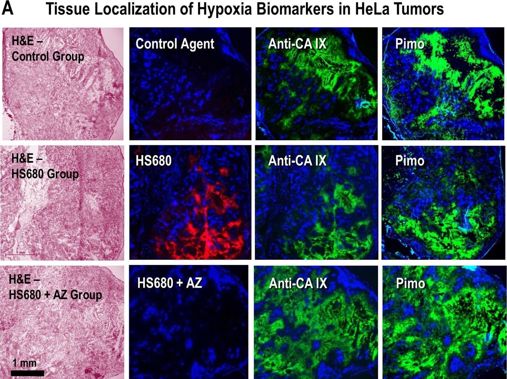 Detection of Carbonic Anhydrase IX/CA9 by Immunohistochemistry