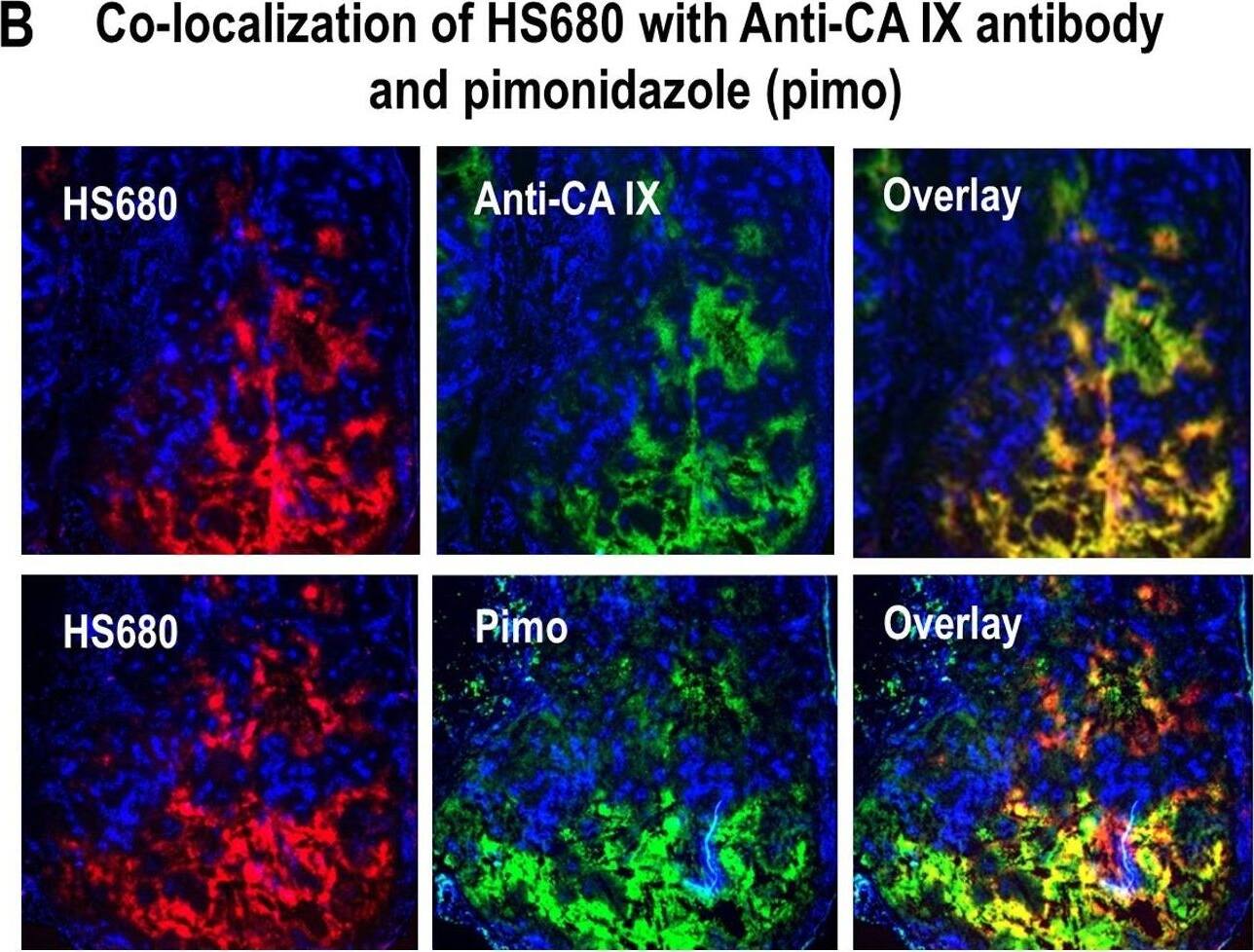 Detection of Carbonic Anhydrase IX/CA9 by Immunohistochemistry