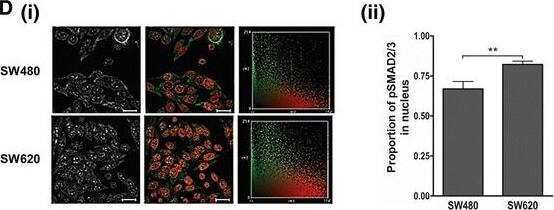 Detection of Human TGF-beta RII by Immunocytochemistry/Immunofluorescence