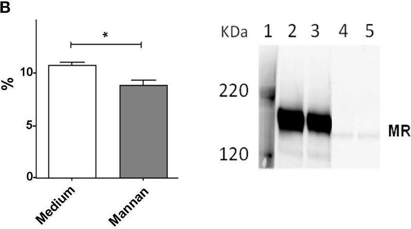Detection of MMR/CD206 by Western Blot