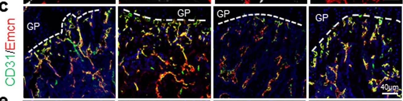 Detection of Mouse CD31/PECAM-1 by Immunohistochemistry