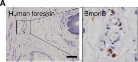Detection of BMPR-IB/ALK-6 by Immunohistochemistry