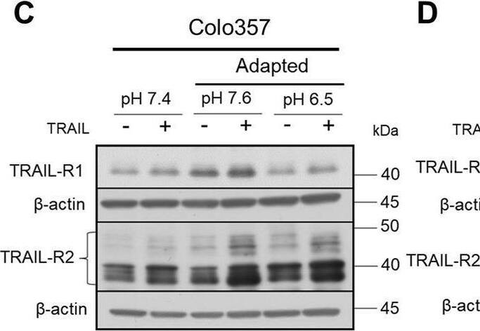 Detection of TRAIL R2/TNFRSF10B by Western Blot