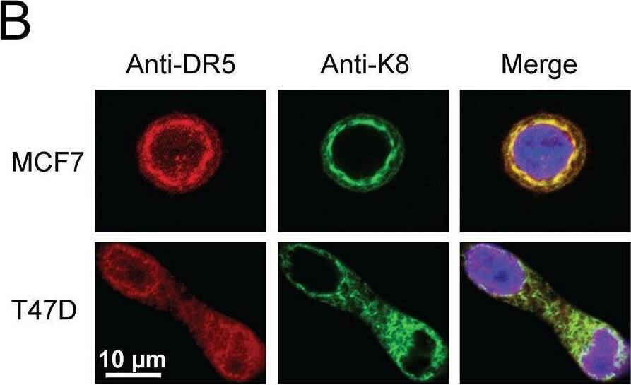 Detection of TRAIL R2/TNFRSF10B by Immunocytochemistry/ Immunofluorescence