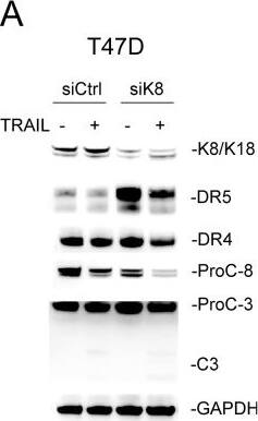 Detection of TRAIL R2/TNFRSF10B by Western Blot
