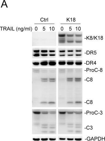 Detection of TRAIL R2/TNFRSF10B by Western Blot