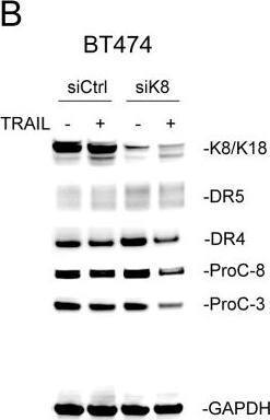 Detection of TRAIL R2/TNFRSF10B by Western Blot