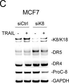 Detection of TRAIL R2/TNFRSF10B by Western Blot